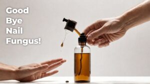 A Patient's Success Story Overcoming Fungal Nail Infection Naturally with Homeopathy
