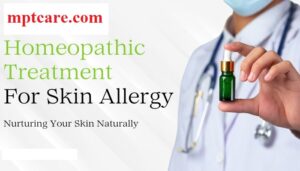 Homeopathy for allergies