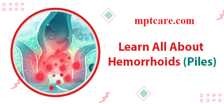 homeopathy and hemorrhoids