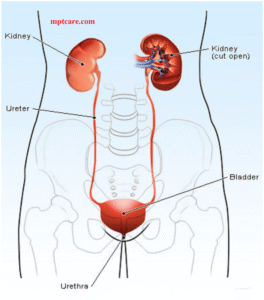 Homeopathy for urine infection