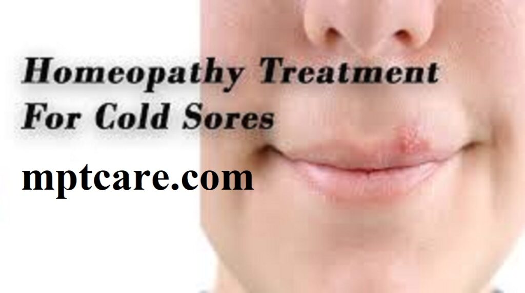 Homeopathy for Cold Sores