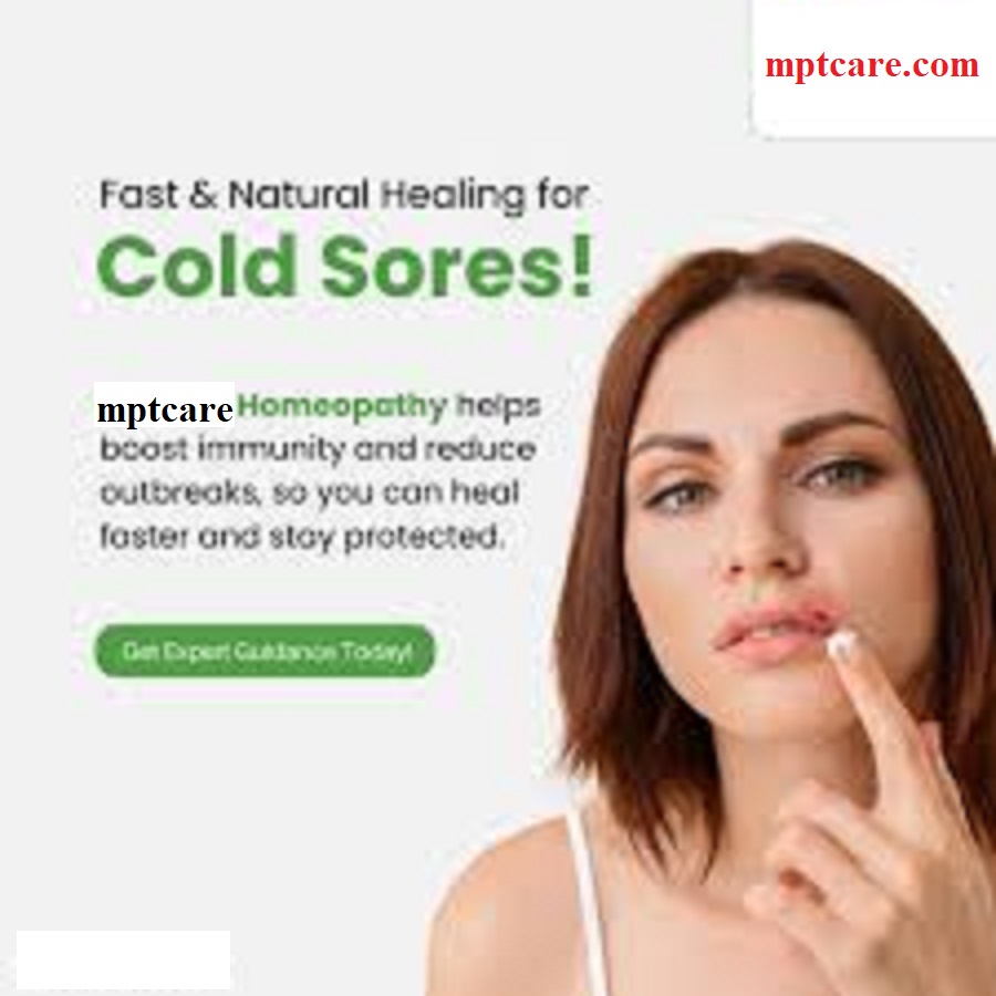 Homeopathy for Cold Sores
