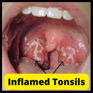 homeopathy for sore throat