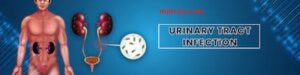 Homeopathy for UTI