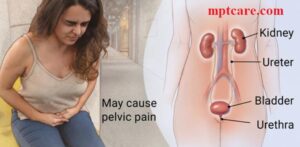 Homeopathy for UTI