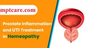 Homeopathy for UTI