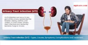 Homeopathy for UTI