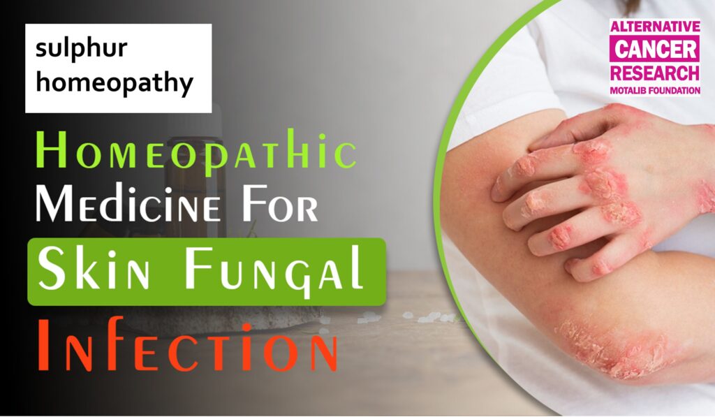 Sulphur Homeopathy