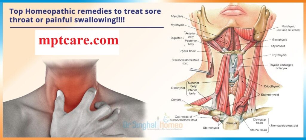 throat pain homeopathy care