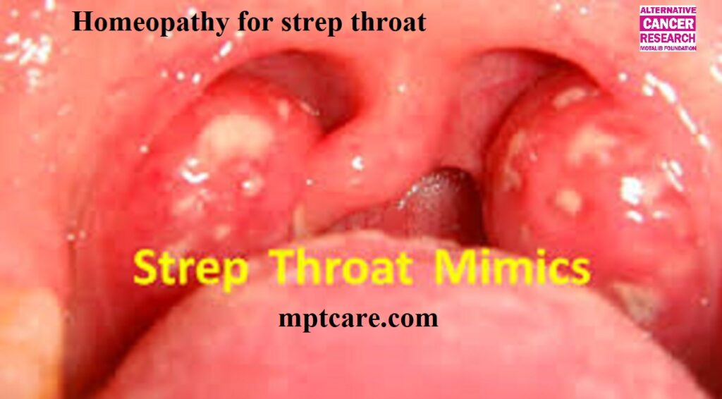 Homeopathy for strep throat