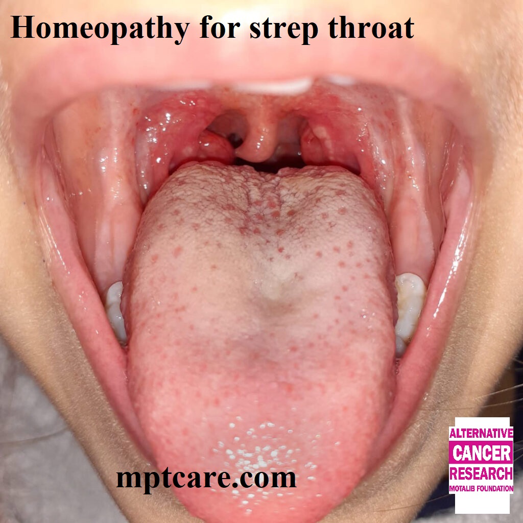 Homeopathy for strep throat