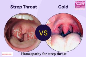 Homeopathy for strep throat