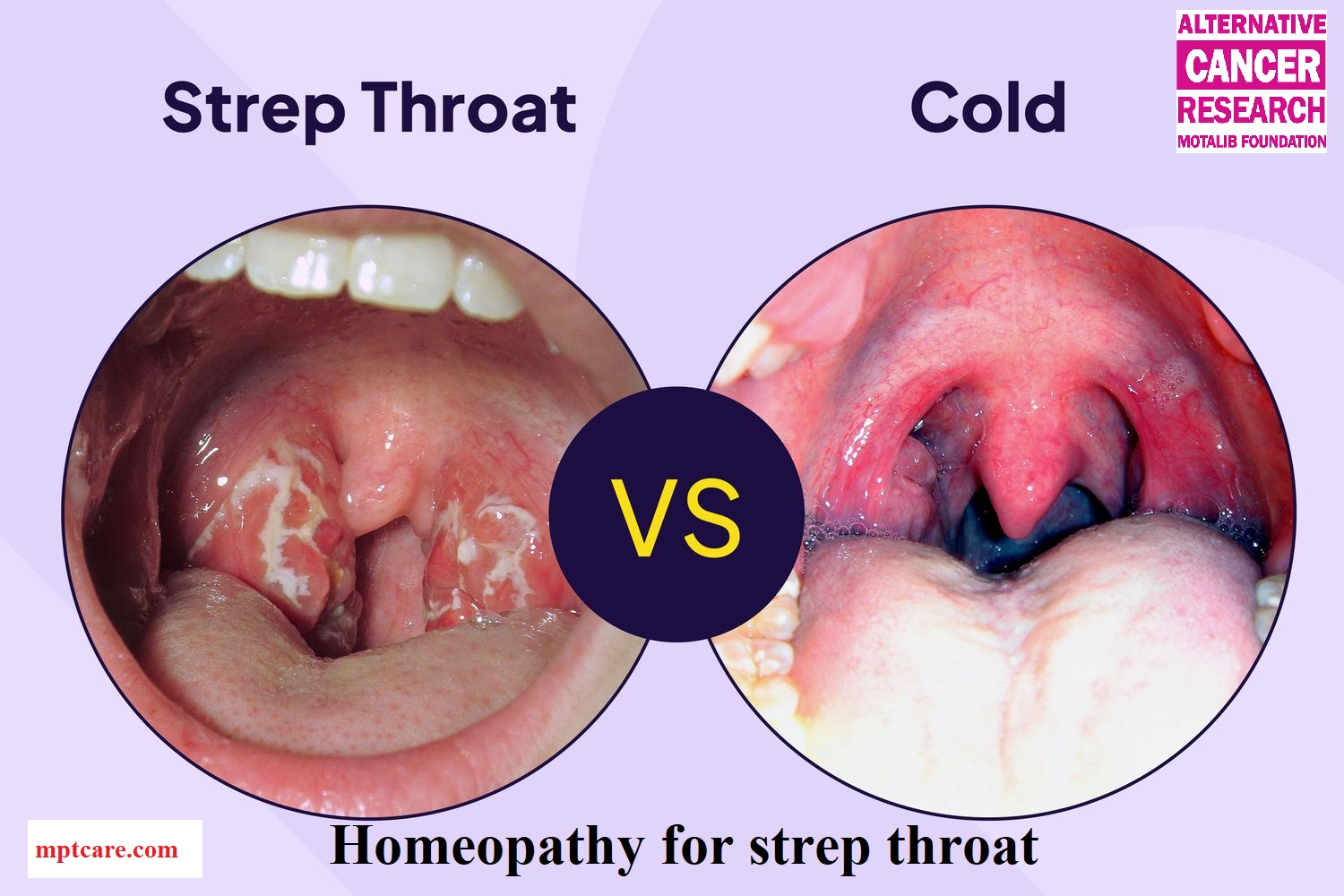 Homeopathy for strep throat