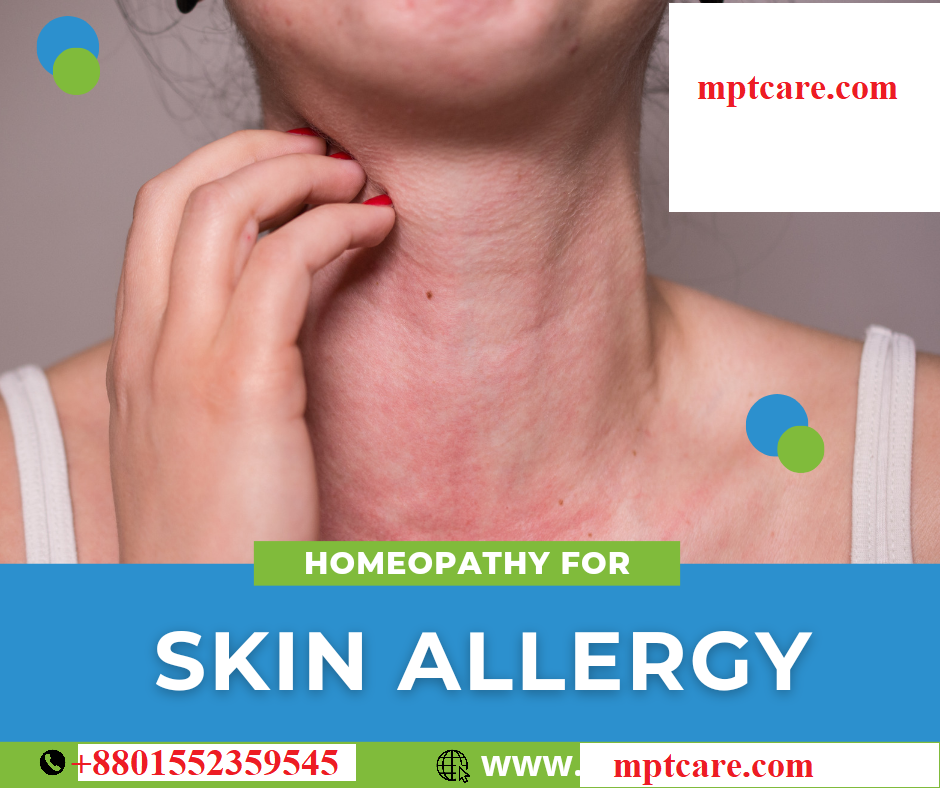 allergic reaction homeopathy