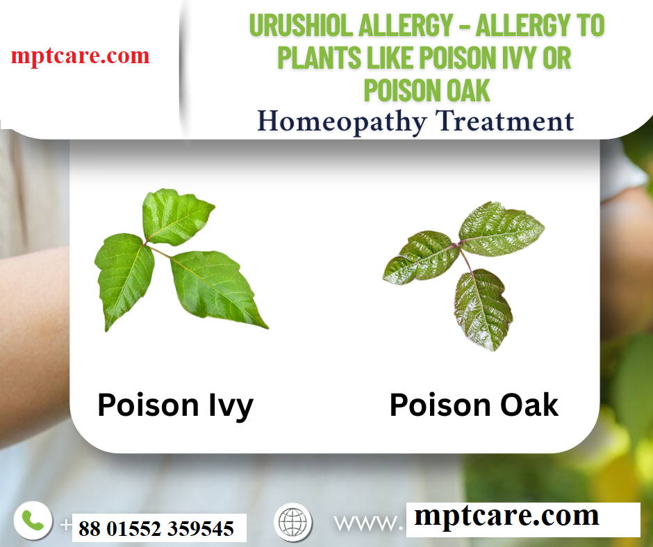 homeopathy for poison ivy