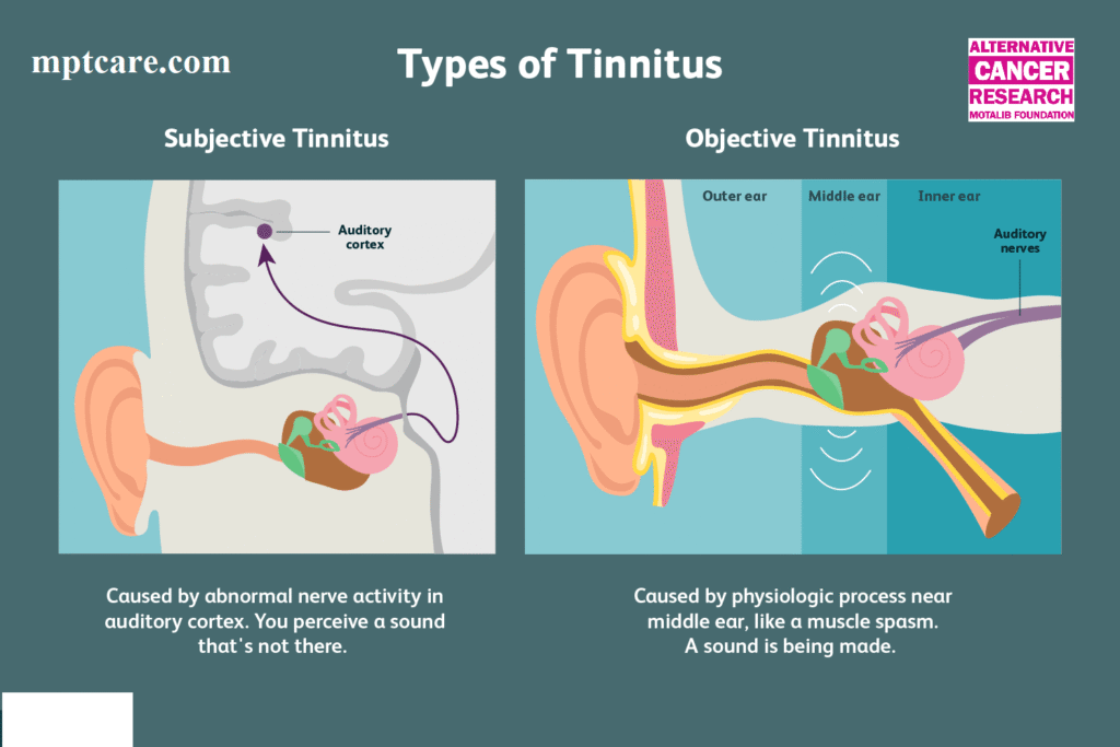 homeopathy for tinnitus